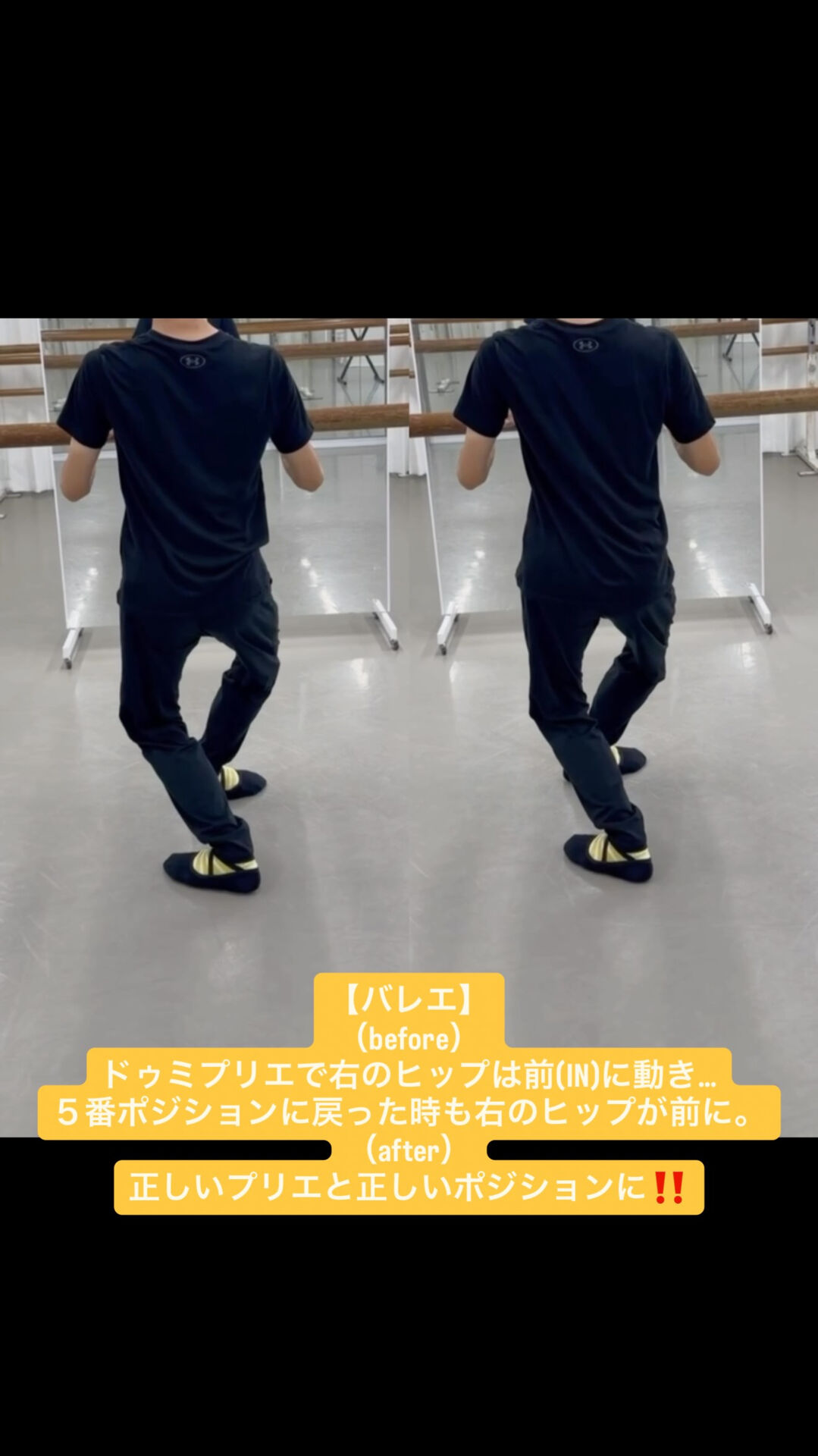 【バレエ】
